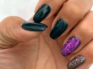 Nagels